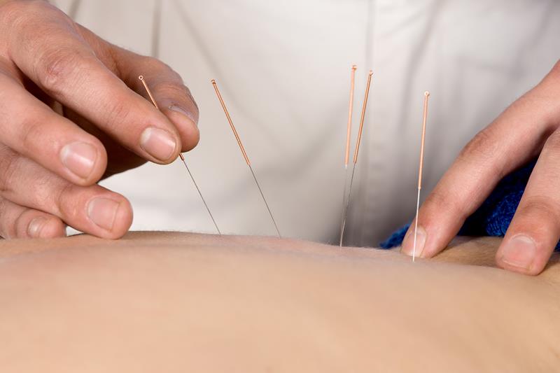Acupuncture Palm Beach Gardens, FL